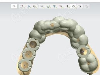 口腔3D打印技术（数字化时代下，口腔3D打印技术助力精准牙科医疗）